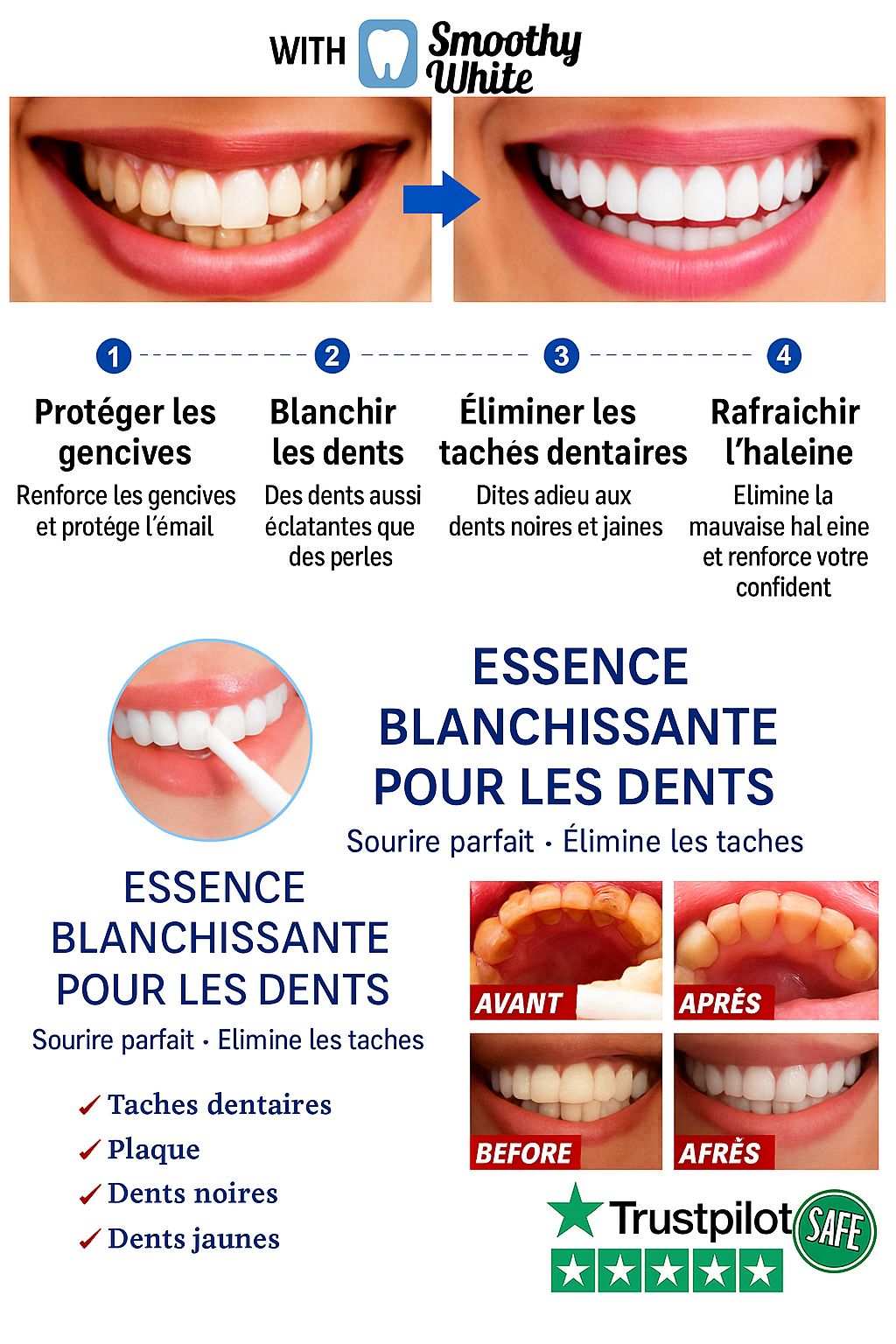 SOURIRE HOLLYWOODIEN EN 1 UTILISATION !