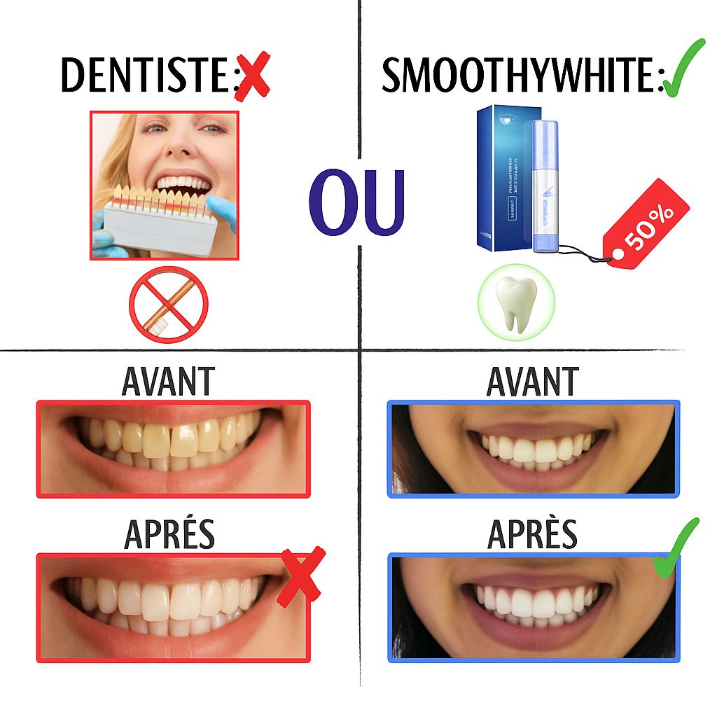 SOURIRE HOLLYWOODIEN EN 1 UTILISATION !
