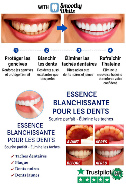 SOURIRE HOLLYWOODIEN EN 1 UTILISATION !
